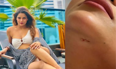 actress archana gautam injured in reality show khatron ke khiladi 13