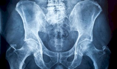 plastic cane put in private part of a man in bikaner