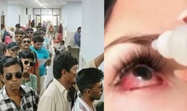 eye flu spread in rajasthan  govt on released guideline know symptoms and prevention
