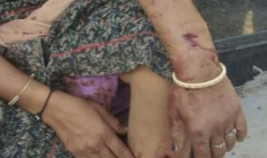 when a report of rape was filed the criminal attacked the family