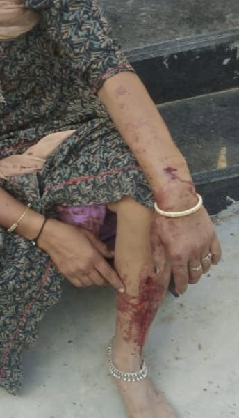 when a report of rape was filed the criminal attacked the family