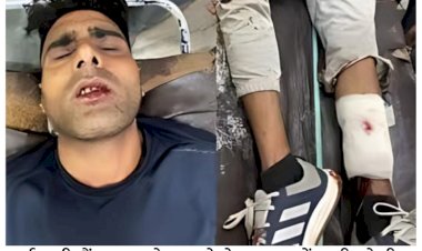 gangster carrying reward of rs 1 lakh made police hostage