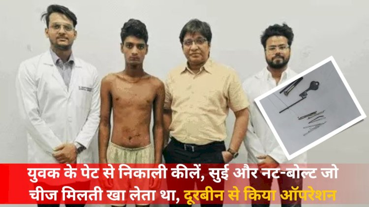 nails nuts bolts and needles were removed from the young mans stomach after an operation through binoculars. he used to eat whatever he got. when he felt pain his family members got him checked