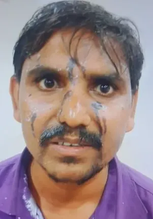 mumbai malad acid attack laborers dispute 600 rupees